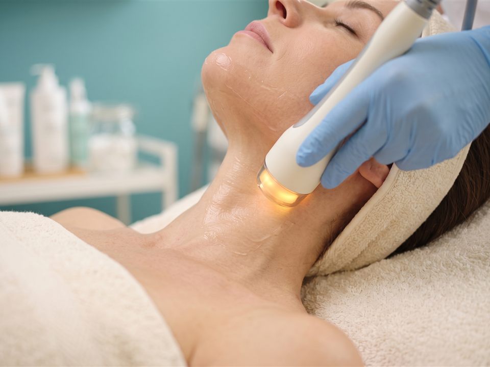 RF skin tightening