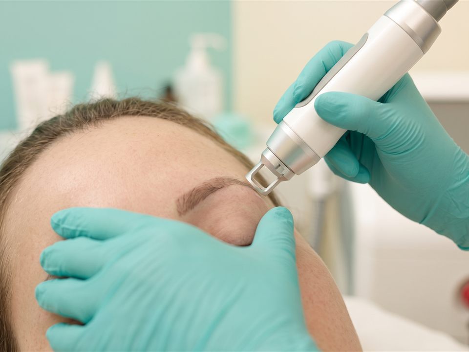 Semi-permanent makeup removal