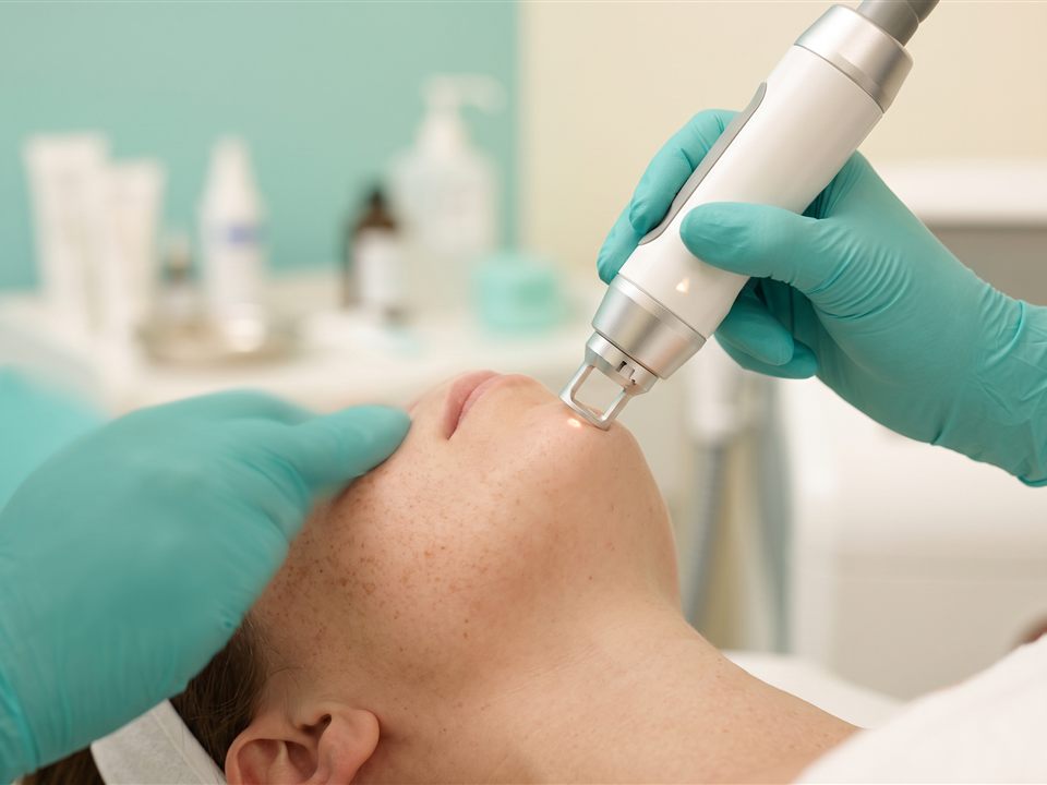 Skin pigmentation removal